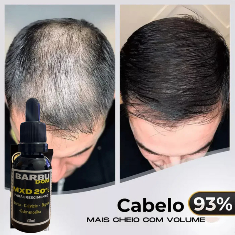 Sérum Capilar MXD20 - PAGUE NA ENTREGA (Receba em menos de 24h)