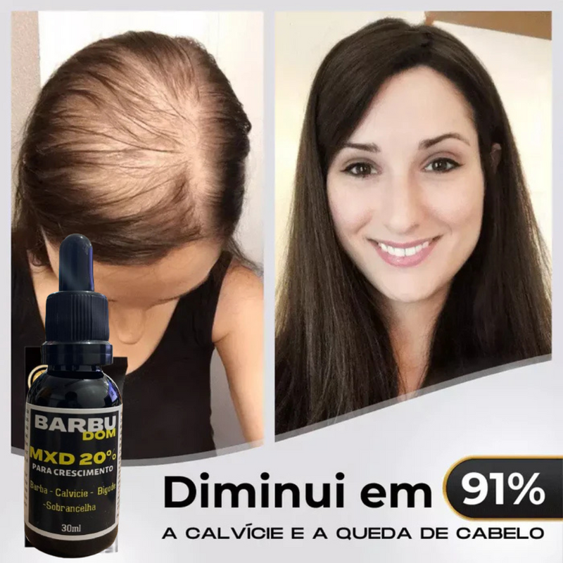 Sérum Capilar MXD20 - PAGUE NA ENTREGA (Receba em menos de 24h)