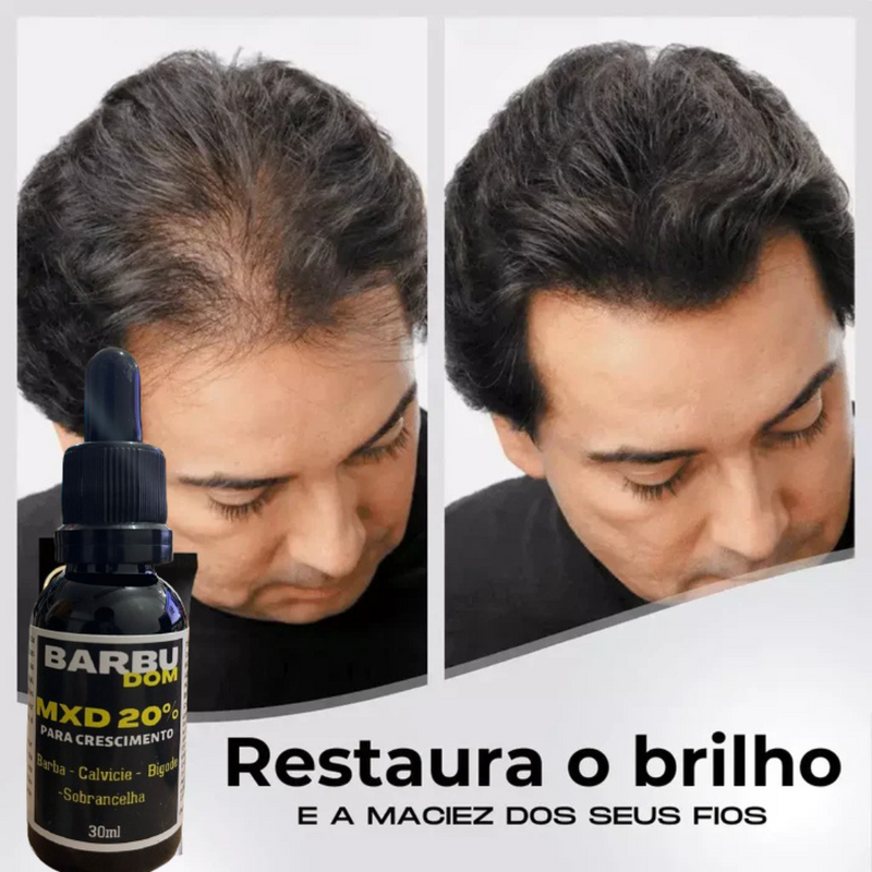 Sérum Capilar MXD20 - PAGUE NA ENTREGA (Receba em menos de 24h)