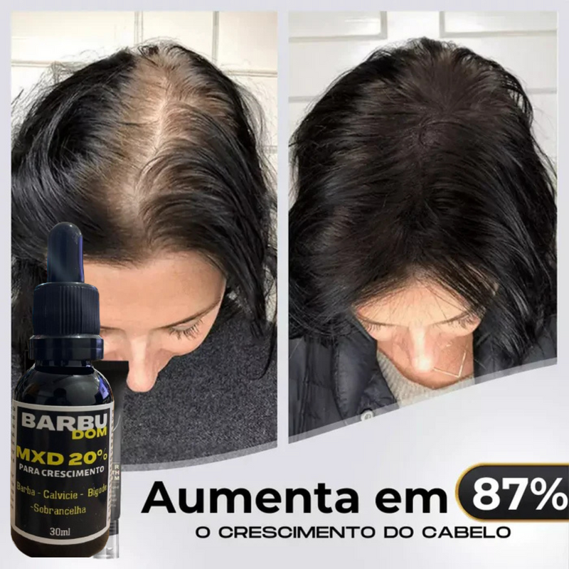 Sérum Capilar MXD20 - PAGUE NA ENTREGA (Receba em menos de 24h)